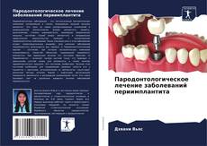 Bookcover of Пародонтологическое лечение заболеваний периимплантита
