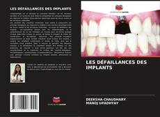 Buchcover von LES DÉFAILLANCES DES IMPLANTS