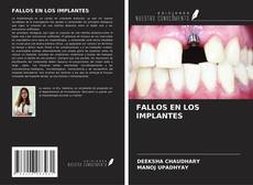 Bookcover of FALLOS EN LOS IMPLANTES