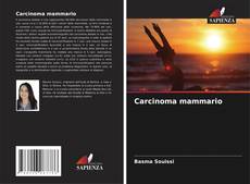 Обложка Carcinoma mammario