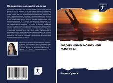 Portada del libro de Карцинома молочной железы