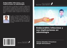 Buchcover von Endocarditis infecciosa y sus implicaciones en odontología
