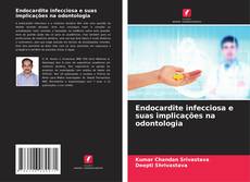 Endocardite infecciosa e suas implicações na odontologia的封面