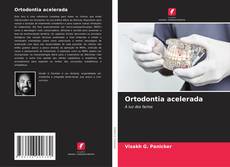 Portada del libro de Ortodontia acelerada