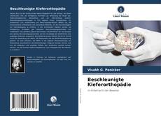 Bookcover of Beschleunigte Kieferorthopädie