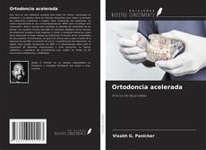Ortodoncia acelerada的封面