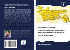 Bookcover of Микрокластерная гранулематозная инфекция лапароскопического порта/ места операции