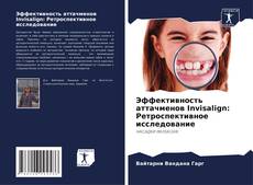 Bookcover of Эффективность аттачменов Invisalign: Ретроспективное исследование