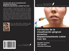 Buchcover von Corrección de la visualización gingival excesiva: Reposicionamiento Labial Con/ Sin