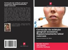 Bookcover of Correcção da exibição gengival excessiva: Reposicionamento labial com/com