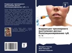 Обложка Коррекция чрезмерного выступания десны: Репозиционирование губ с / с