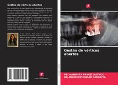 Bookcover of Gestão de vértices abertos