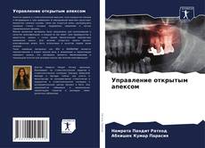 Управление открытым апексом kitap kapağı