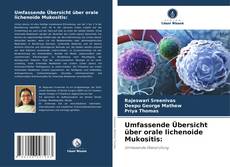 Portada del libro de Umfassende Übersicht über orale lichenoide Mukositis: