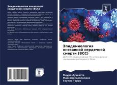 Bookcover of Эпидемиология внезапной сердечной смерти (ВСС)