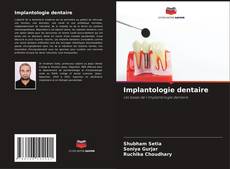 Buchcover von Implantologie dentaire