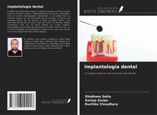 Implantología dental的封面