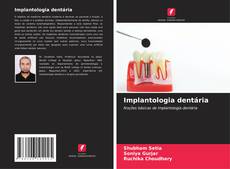 Обложка Implantologia dentária
