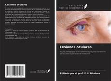 Lesiones oculares kitap kapağı