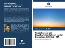 Copertina di Tuberkulose bei Haushaltskontakten in der Gemeinde CAXIAS - MA