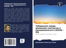 Buchcover von Туберкулез среди домашних контактов в муниципалитете CAXIAS - MA