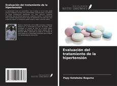 Bookcover of Evaluación del tratamiento de la hipertensión