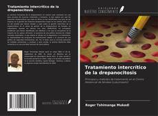 Couverture de Tratamiento intercrítico de la drepanocitosis