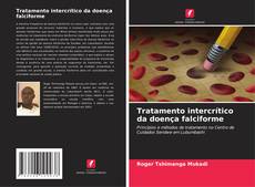 Tratamento intercrítico da doença falciforme的封面