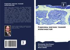 Couverture de Саркомы мягких тканей конечностей