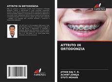 Copertina di ATTRITO IN ORTODONZIA