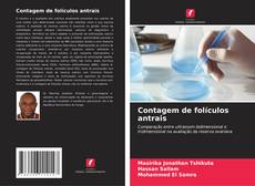 Bookcover of Contagem de folículos antrais