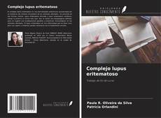Buchcover von Complejo lupus eritematoso