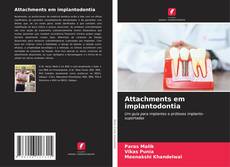 Buchcover von Attachments em implantodontia