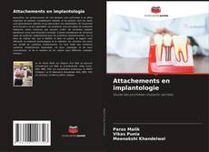 Buchcover von Attachements en implantologie