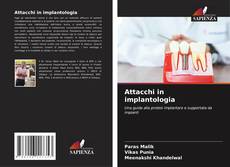 Couverture de Attacchi in implantologia