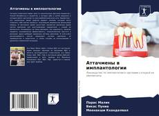 Bookcover of Аттачмены в имплантологии