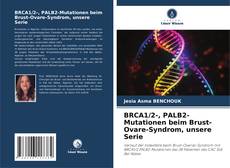 BRCA1/2-, PALB2-Mutationen beim Brust-Ovare-Syndrom, unsere Serie的封面