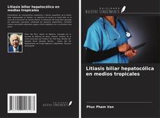 Buchcover von Litiasis biliar hepatocólica en medios tropicales