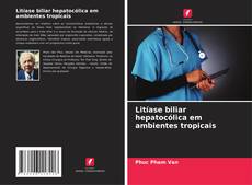 Buchcover von Litíase biliar hepatocólica em ambientes tropicais