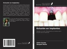 Capa do livro de Oclusión en implantes 