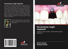 Обложка Occlusione negli impianti