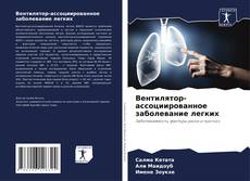 Buchcover von Вентилятор-ассоциированное заболевание легких