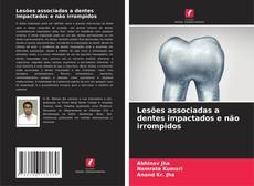 Bookcover of Lesões associadas a dentes impactados e não irrompidos