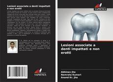 Copertina di Lesioni associate a denti impattati e non erotti