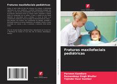 Buchcover von Fraturas maxilofaciais pediátricas
