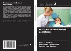 Buchcover von Fracturas maxilofaciales pediátricas