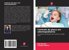 Bookcover of Controle de placa em odontopediatria