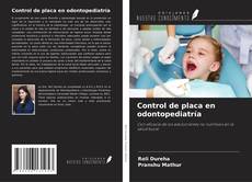 Buchcover von Control de placa en odontopediatría