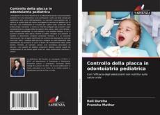 Bookcover of Controllo della placca in odontoiatria pediatrica
