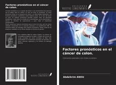 Capa do livro de Factores pronósticos en el cáncer de colon. 